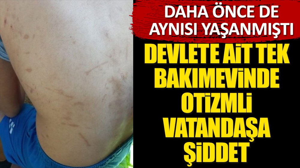 Devlete ait tek bakımevinde otizmli vatandaşa şiddet. Daha önce de aynısı yaşanmıştı