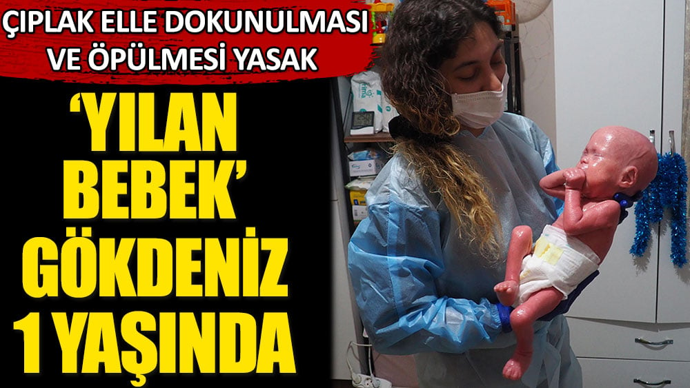 ‘Yılan bebek’ Gökdeniz 1 yaşında. Çıplak elle dokunulması öpülmesi yasak