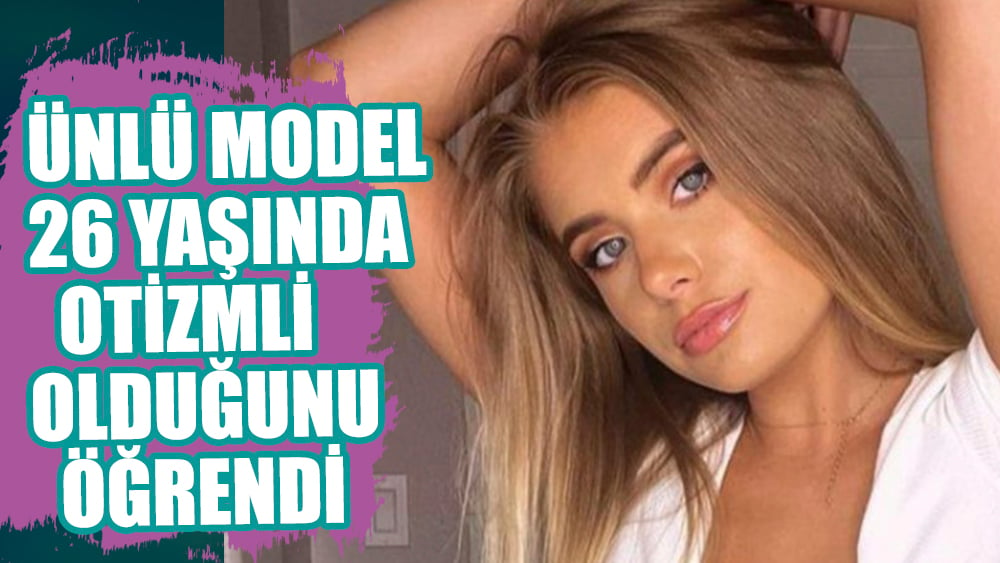 Ünlü model 26 yaşında otizmli olduğunu öğrendi