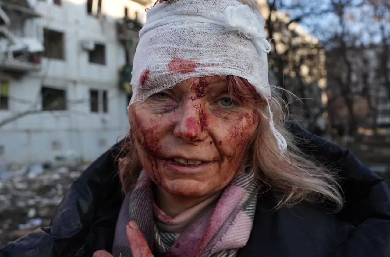 Savaştan kaçan Ukraynalı kadınlar hakkında yapılan utanç verici paylaşımlar