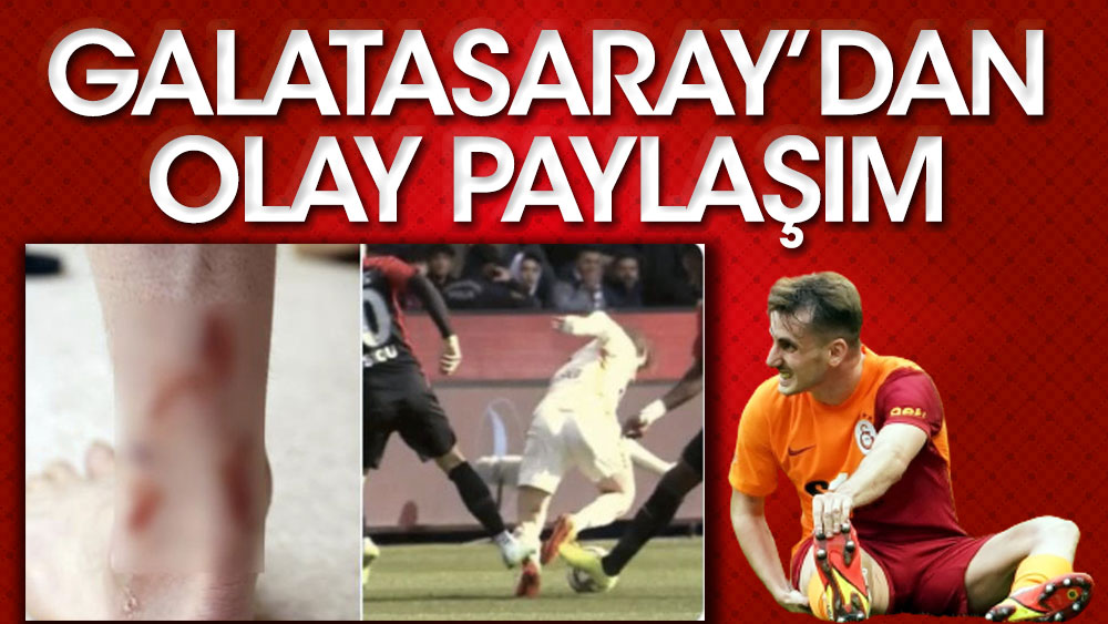 Galatasaray, Kerem'in ayağını paylaştı: Karşılığında kart yok!