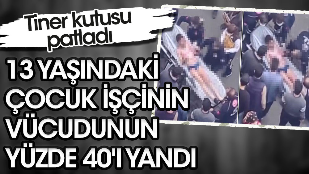 Diyarbakır'da tiner kutusu patladı. 13 yaşındaki çocuk işçinin vücudunun yüzde 40'ı yandı