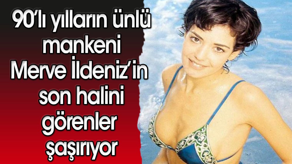 İşte ünlü manken Merve ildeniz'in, son hali