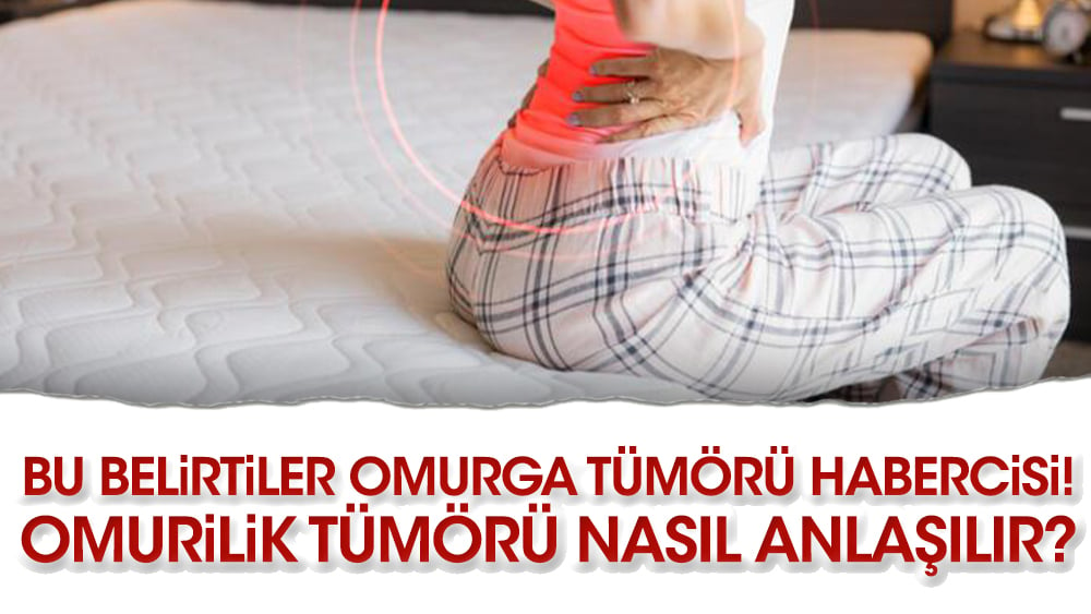 Bu belirtiler omurga tümörü habercisi! Omurilik tümörü nasıl anlaşılır?