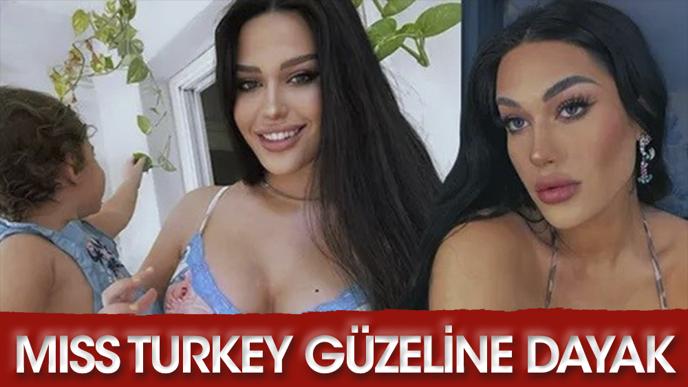 Miss Turkey güzeli Gizem Koçak ve küçük kızına misafirlikte dayak!