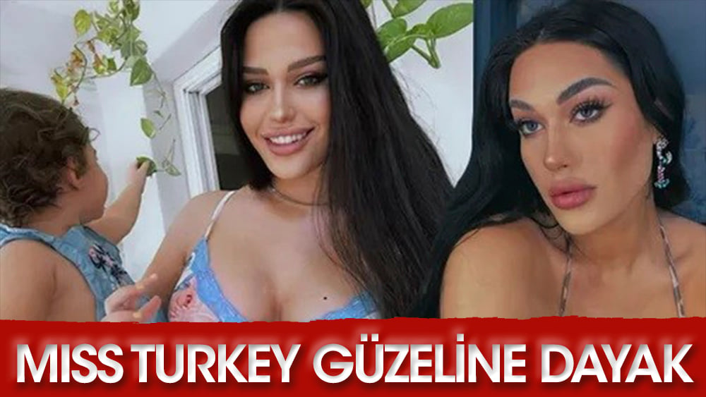 Miss Turkey güzeli Gizem Koçak ve küçük kızına misafirlikte dayak!