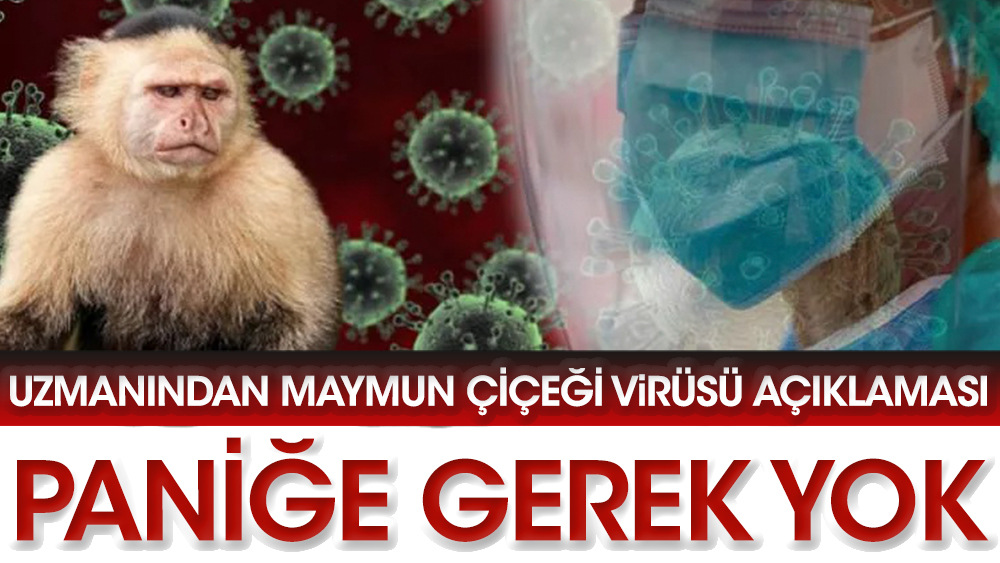 Prof. Dr. Oğuztürk’ten Maymun çiçeği virüsü açıklaması: Paniğe gerek yok