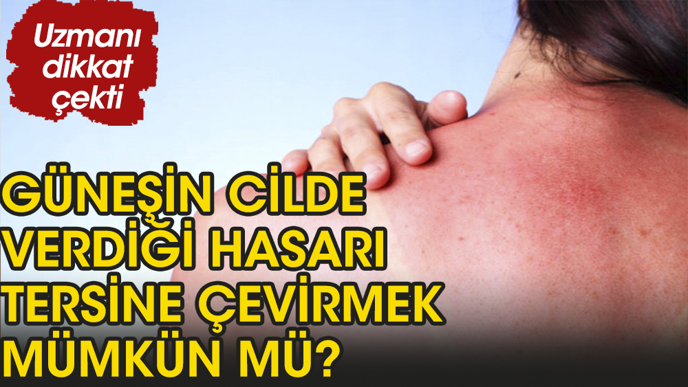 Güneşin cilde verdiği hasarı tersine çevirmek mümkün mü?