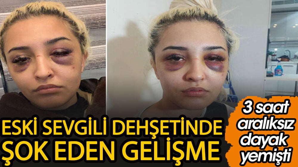 Eski sevgili dehşetinde şok eden gelişme. 3 saat aralıksız dayak yemişti