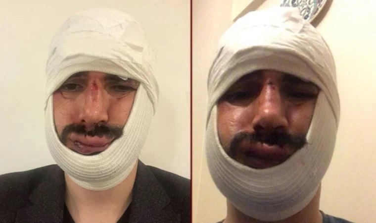 Anadolu Ajansı muhabirine saldıran iki sanığa hapis cezası