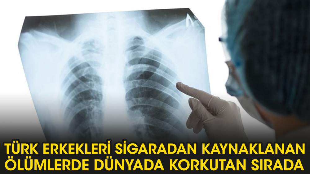 Türk erkekleri sigaradan kaynaklanan ölümde dünyada korkutan sırada