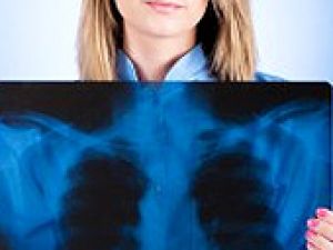 Akciğer kanseri Avrupa'da yükselişte