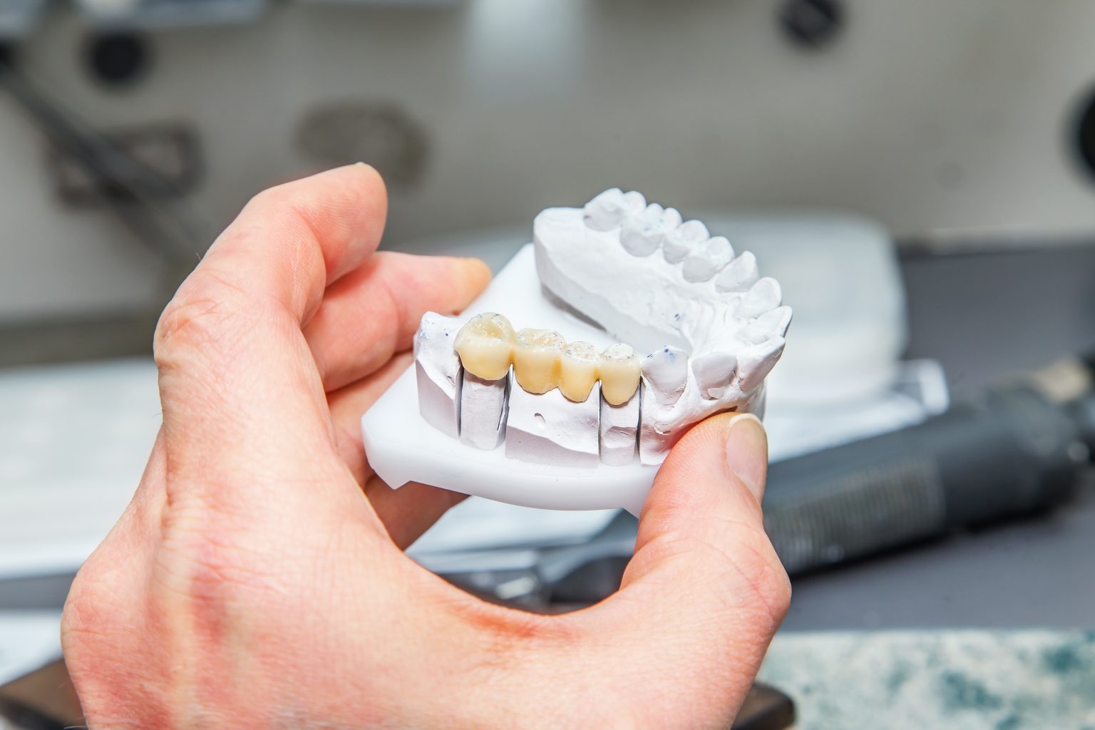 Balgat Ağız Ve Diş Sağlığı Merkezi diş protez alacak