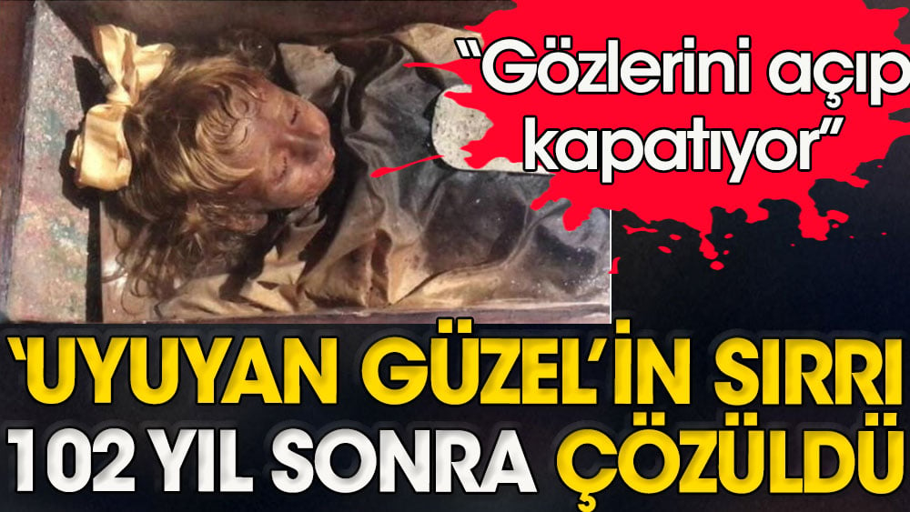 ''Gözünü açıp kapatıyor'' iddiası: Uyuyan Güzel'in 102 yıllık sırrı çözüldü