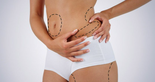 Vaser Liposuction Yöntemleri Nelerdir?