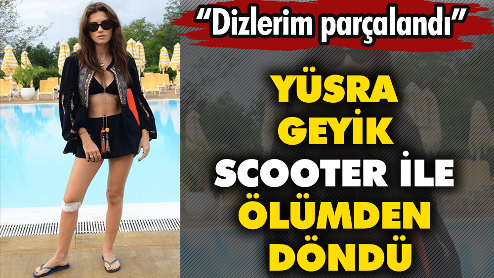 Yüsra Geyik scooter ile ölümden döndü! ''Dizlerim parçalandı''