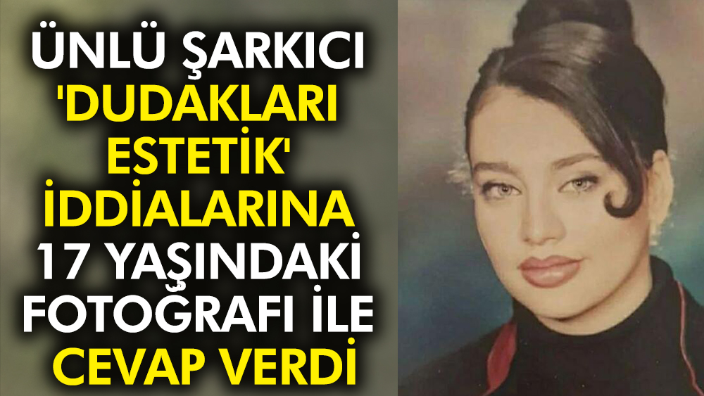 Ünlü şarkıcı Umut Akyürek 'dudakları estetik' iddialarına 17 yaşındaki fotoğrafı ile cevap verdi