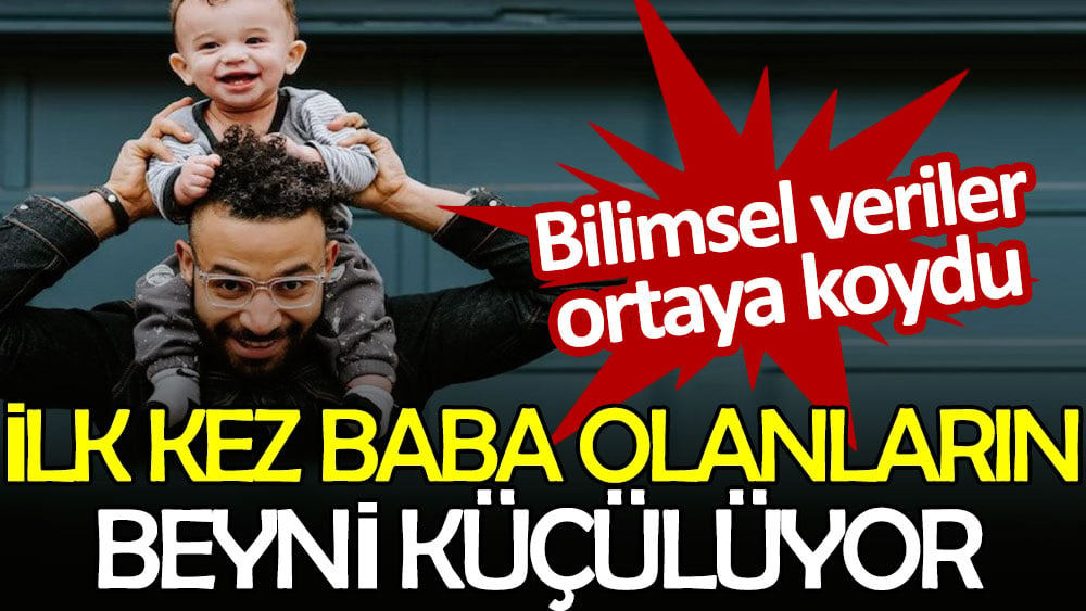 İlk kez baba olanların beyni küçülüyor. Bilimsel veriler ortaya koydu