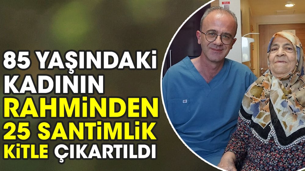 85 yaşındaki kadının rahminden 25 santimlik kitle çıkartıldı