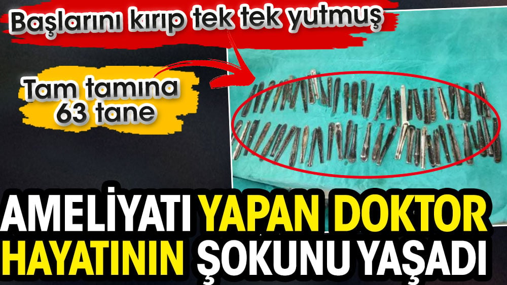 Ameliyatı yapan doktor hayatının şokunu yaşadı. Başlarını kırıp tek tek yutmuş. Tam tamına 63 tane