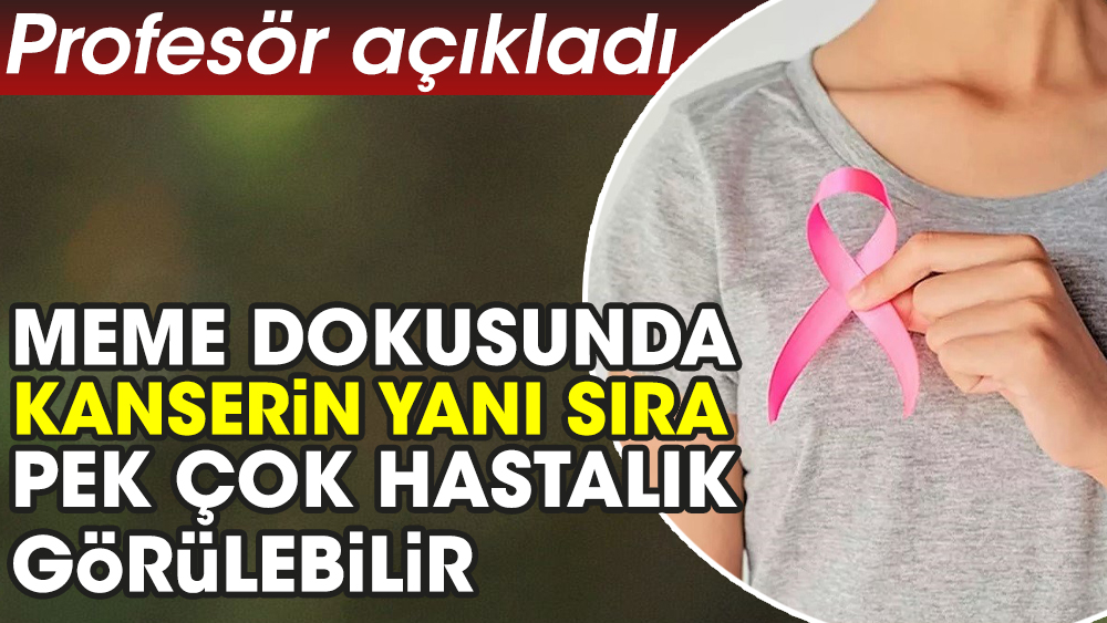 Meme dokusunda kanserin yanı sıra pek çok hastalık görülebilir. Profesör açıkladı