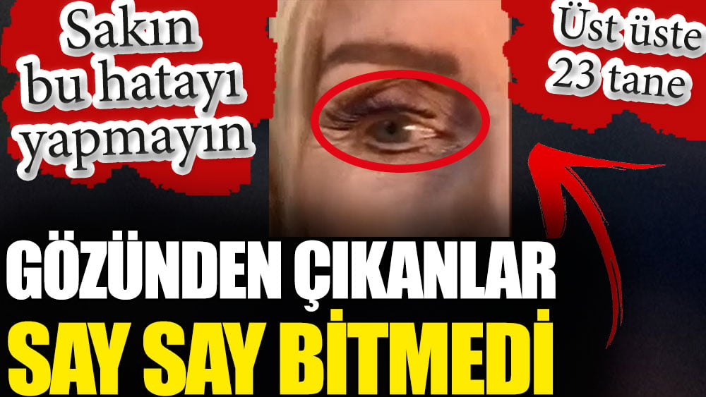 Gözünden çıkanlar say say bitmedi. Sakın bu hatayı yapmayın. 23 tane olduğunu gören doktor gözlerine inanamadı