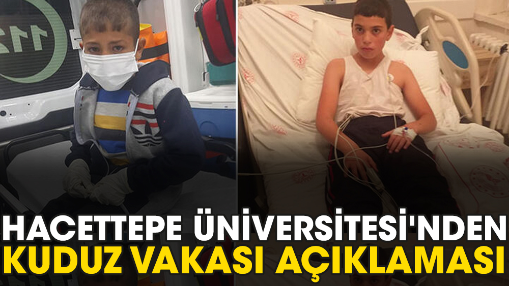 Hacettepe Üniversitesi'nden kuduz vakası açıklaması