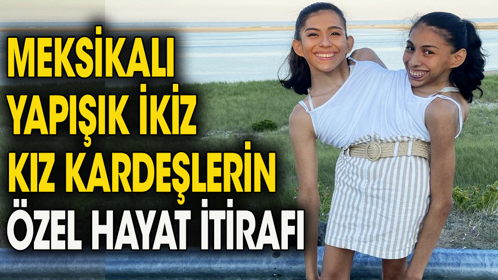 Yapışık kız kardeşler özel hayatlarını itiraf ettiler. Her soruyu açıkça cevapladılar