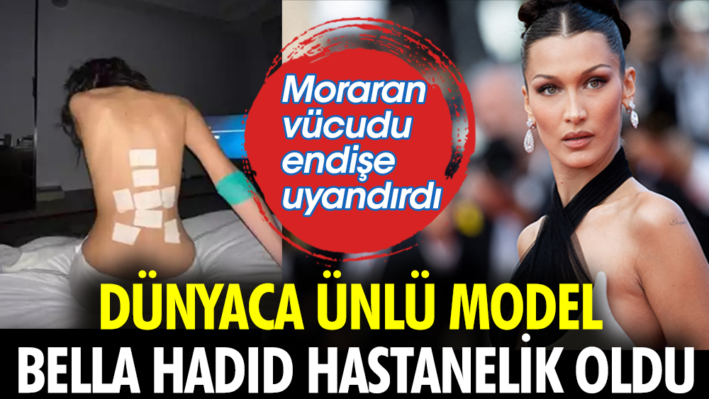 Dünyaca ünlü model Bella Hadid hastanelik oldu. Moraran vücudu endişe uyandırdı