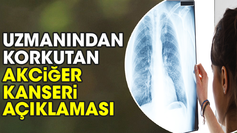 Uzmanından korkutan akciğer kanseri açıklaması