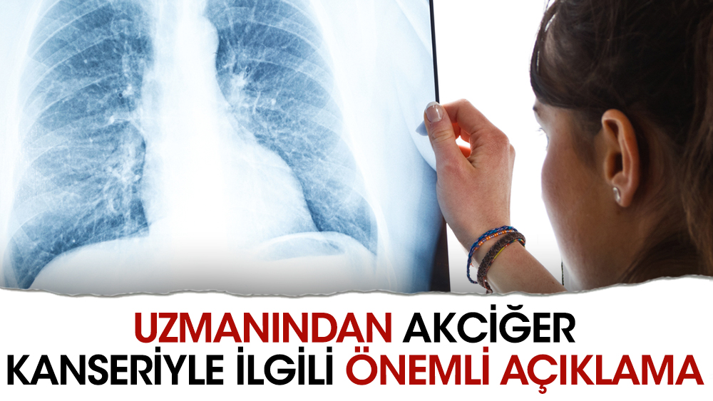 Uzmanından akciğer kanseriyle ilgili önemli açıklama