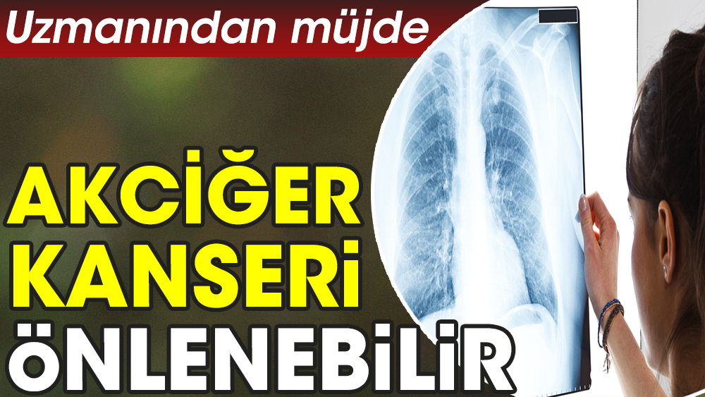 Uzmanından müjde: Akciğer kanseri önlenebilir