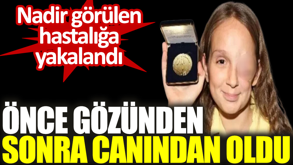 Nadir görülen hastalığa yakalandı. Önce gözünden sonra canından oldu