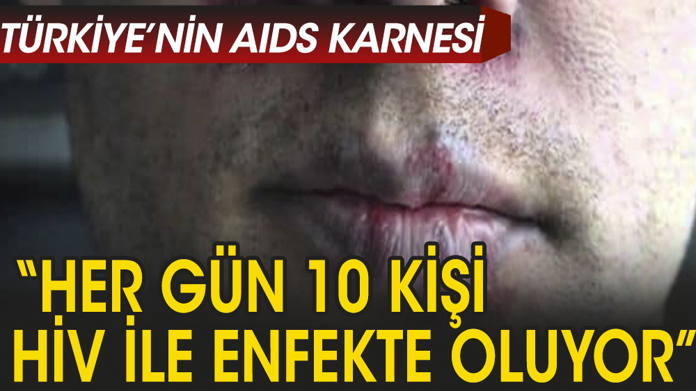 Türkiye’de günde 10 kişi HIV ile enfekte oluyor