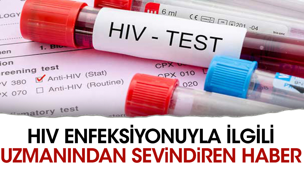 HIV enfeksiyonuyla ilgili uzmanından sevindiren haber