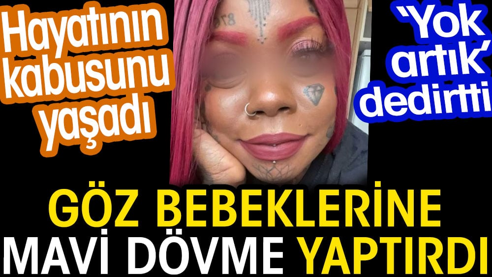 Göz bebeklerine mavi dövme yaptırdı. Hayatının kabusunu yaşadı