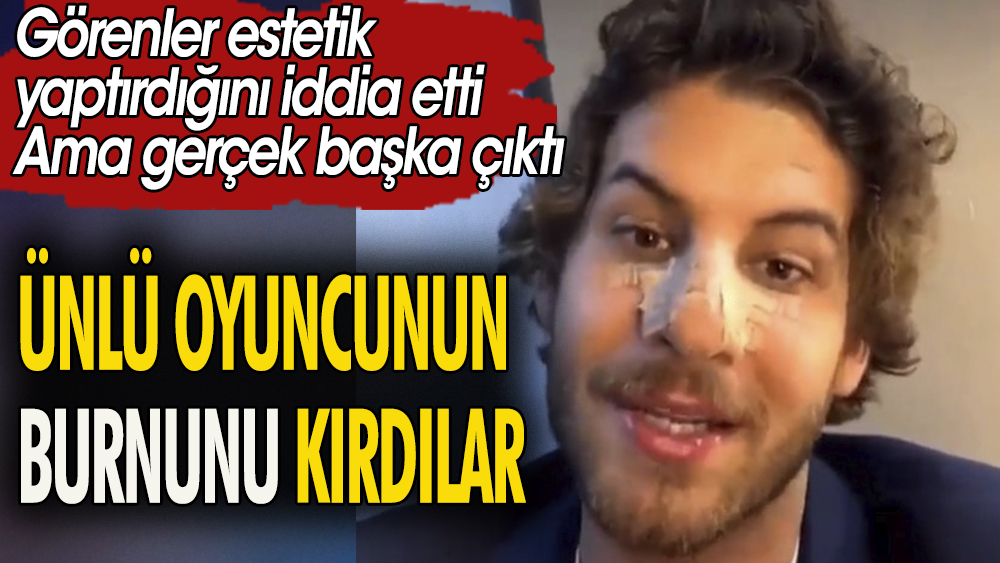 Mustafa Mert Koç'un burnu 4 yerinden kırıldı. Görenler önce estetik yaptırdığını iddia ettiler