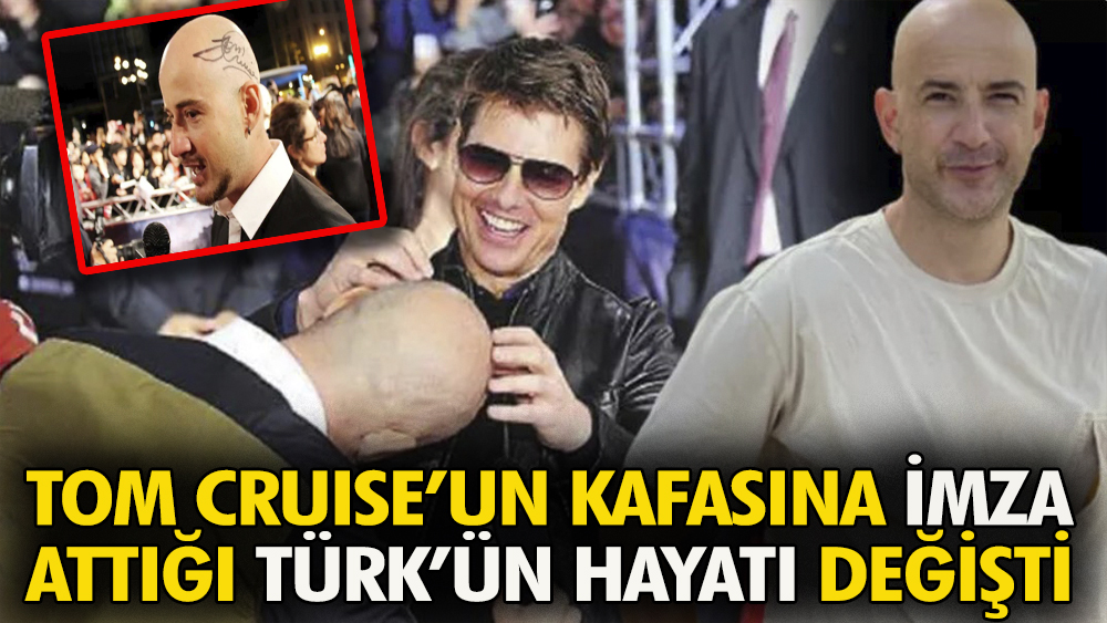 Dünyaca ünlü aktör Tom Cruise, kafasına imza attı. Hayatı bir anda değişti