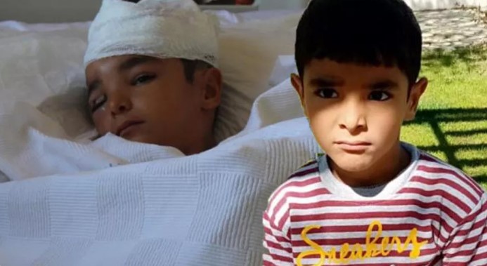 6 yaşındaki çocuk dehşeti yaşadı! Kafa derisinin sağ tarafı soyuldu