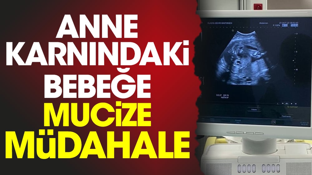 Anne karnındaki bebeğe mucize müdahale