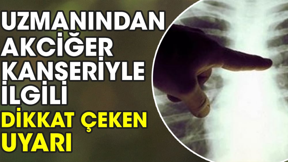 Uzmanından akciğer kanseriyle ilgili dikkat çeken uyarı