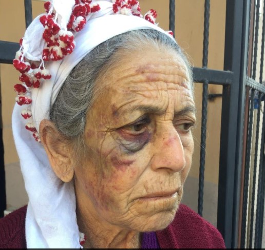 Kanser hastası yaşlı kadını dakikalarca dövüp gasp etti 