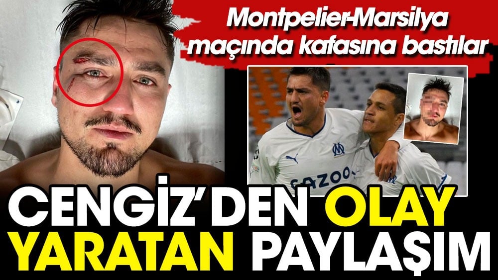 Milli yıldız ölümden döndü. Cengiz Ünder'in paylaşımı şoke etti