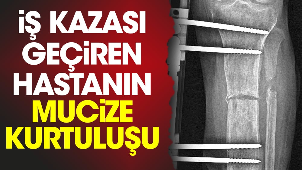 İş kazası geçiren hastanın mucize kurtuluşu