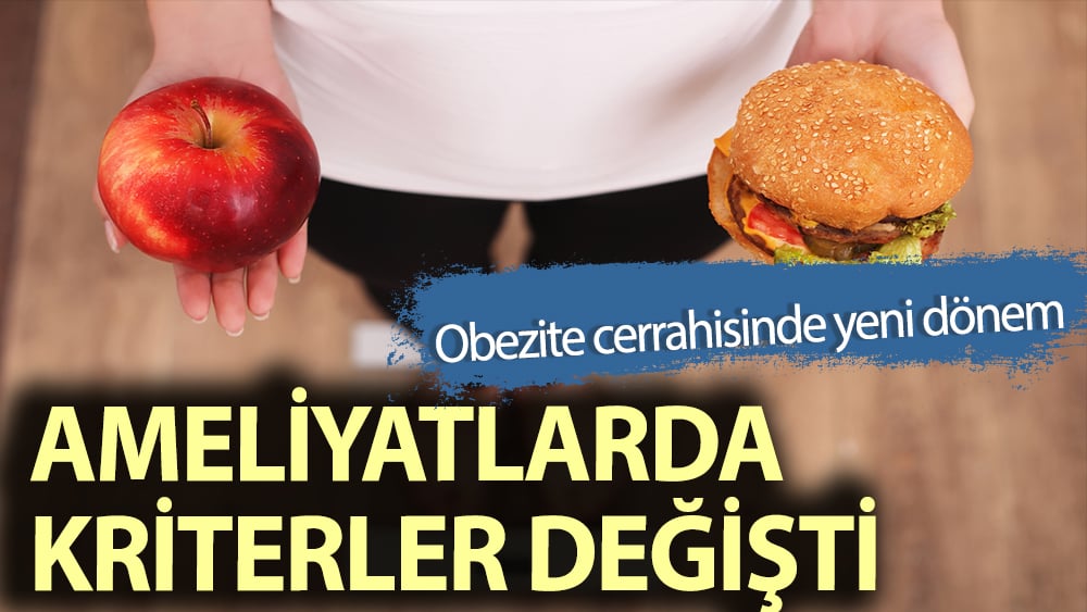 Obezite ameliyatlarında kriterler değişti