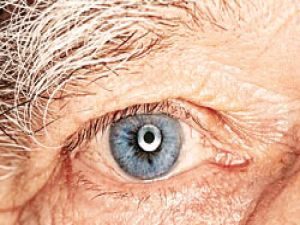 Göz sağlığı 40 yaşından sonra bozulmaya başlıyor