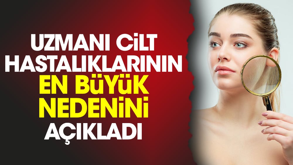 Uzmanı cilt hastalıklarının en büyük nedenini açıkladı