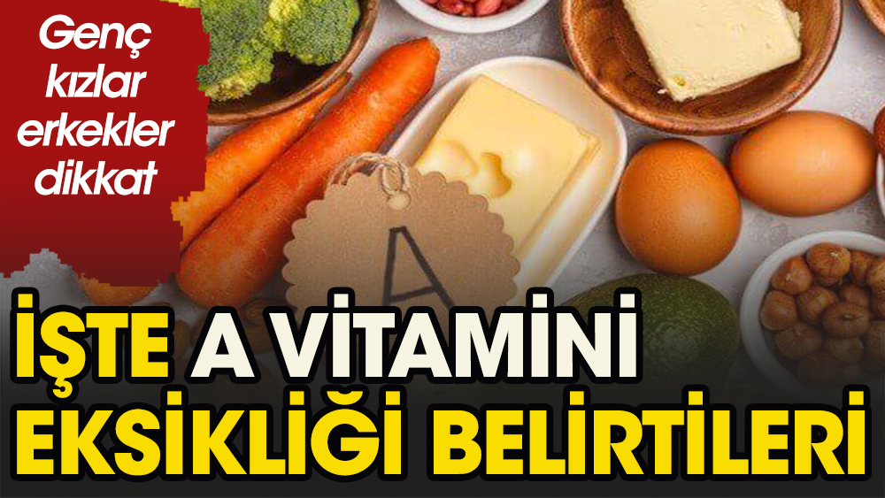 A vitamini eksikliği belirtileri nelerdir sivilce ile ne alakası var?