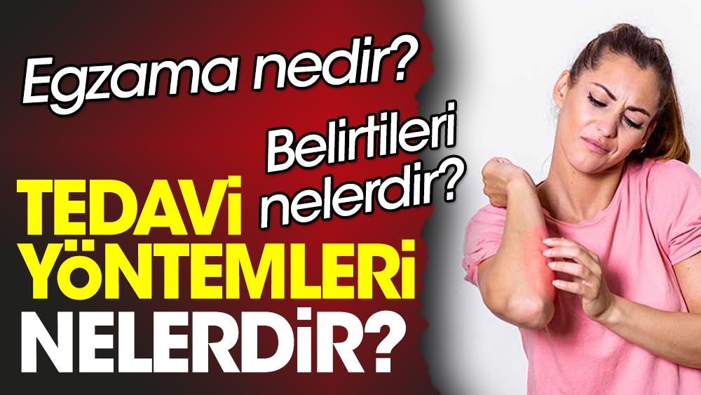 Egzama nedir? Egzama belirtileri nelerdir? Egzama tedavi yöntemleri nelerdir?