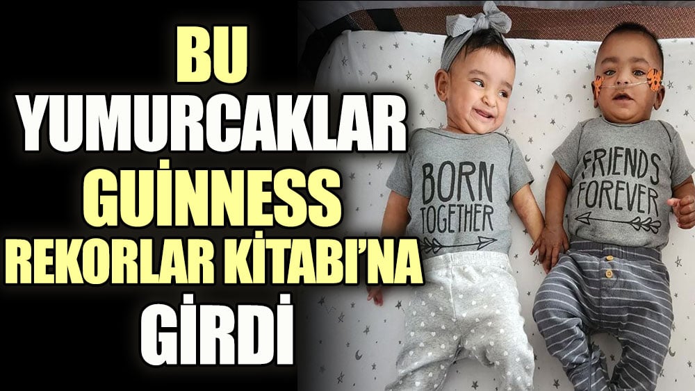 Bu yumurcaklar Guinness Rekorlar Kitabı’na girdi